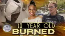 10 Year Old Black Boy Severely Burned After WW Throws Boiling Water On Him